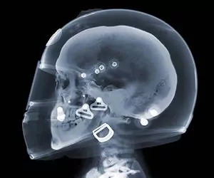 motorcycle helmet x-ray